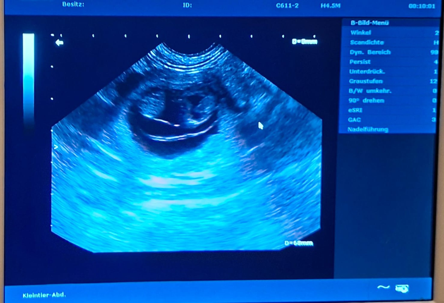 Ultraschallbild von Kiowa